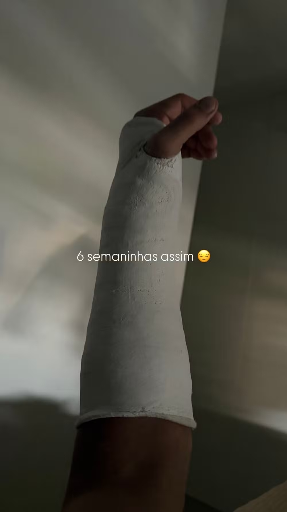 Jonas Sulzbach revela "novas habilidades" após fraturar o braço.. Foto: Reprodução/Instagram/@jonassulzbach