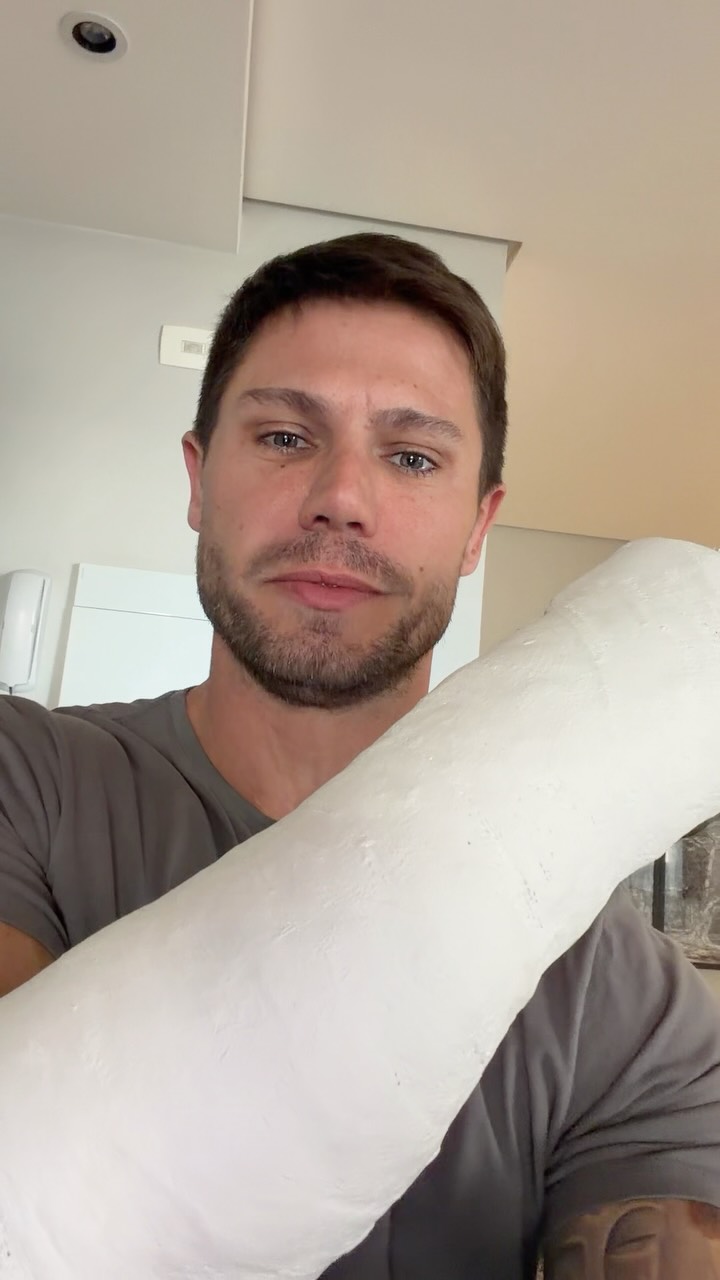 Jonas Sulzbach relata "novas habilidades" após fraturar o braço . Foto: Reprodução/Instagram/@jonassulzbach